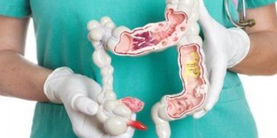 احم نفسك.. أهمية الفحص المبكر للوقاية من سرطان القولون - في المدرج